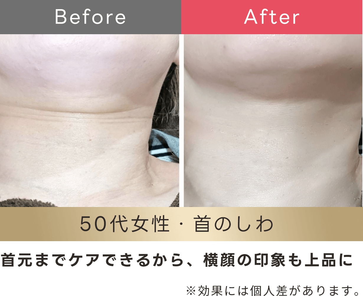 首元までケアできるから、横顔の印象も上品に
