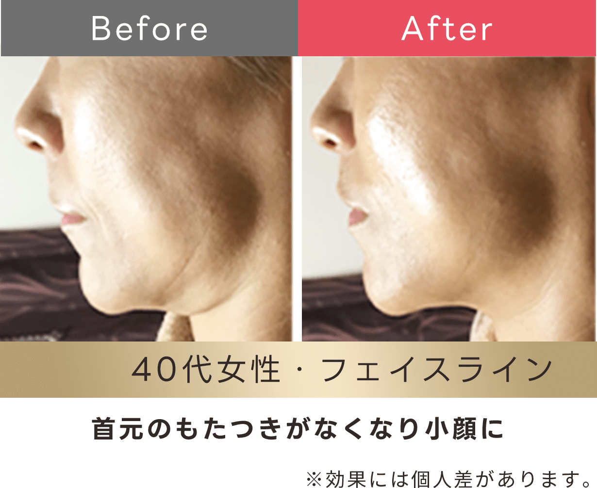 首元のもたつきがなくなり小顔に